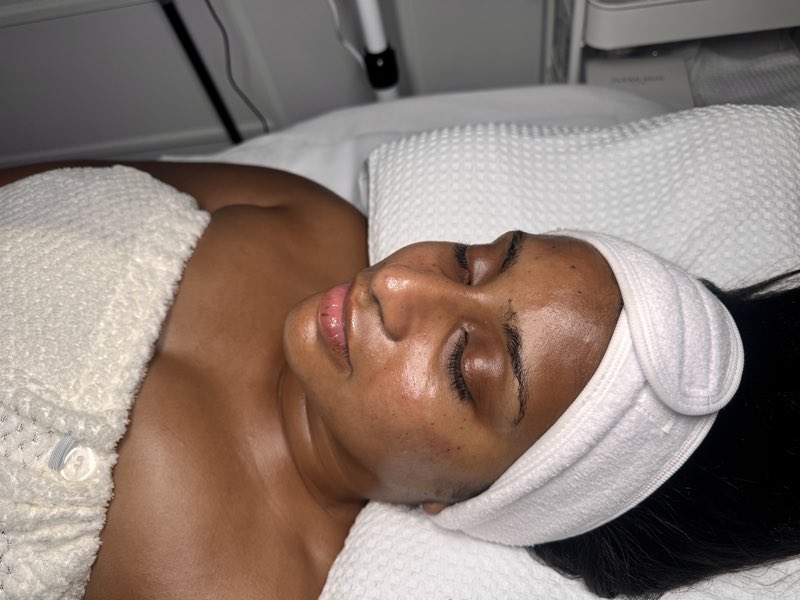 After treatment