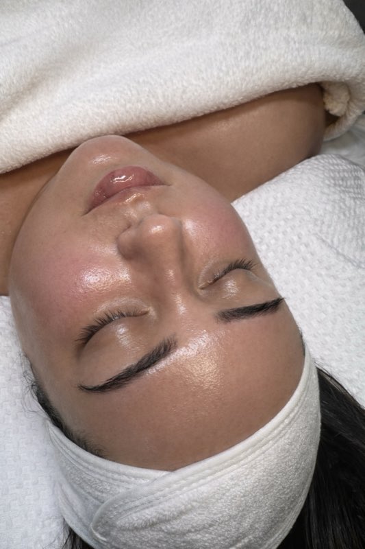 After treatment
